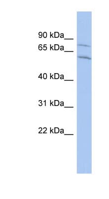 CNOT2 Antibody (aa251-300)
