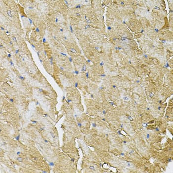 Polyclonal Rabbit anti-Human TRPC1 Antibody (IHC, WB)