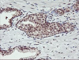 HLCS / HCS Antibody (clone OTI1E4)