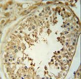 Polyclonal Rabbit anti-Human CPNE8 / Copine VIII Antibody (aa73-101, IHC, WB)