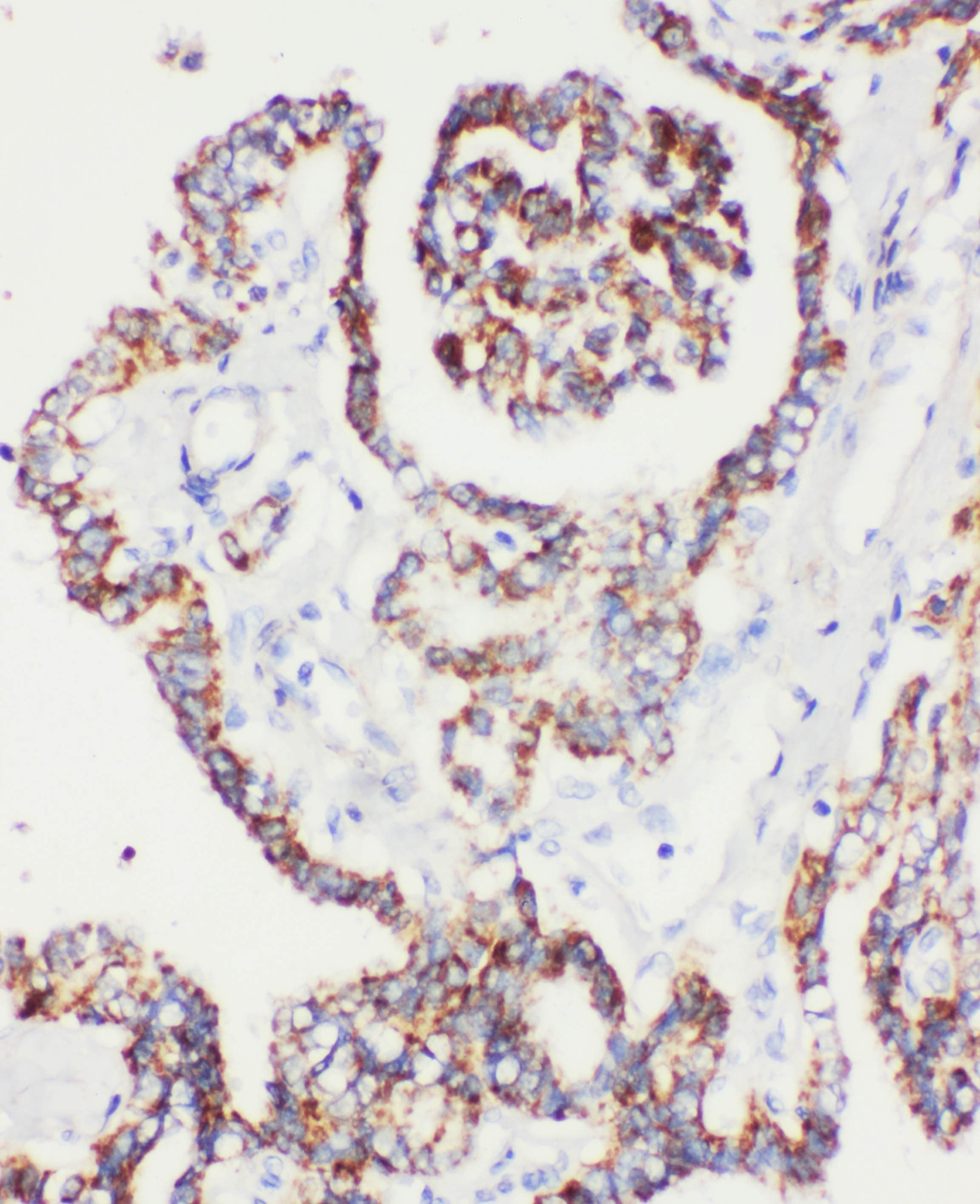 Polyclonal Rabbit anti-Human PRDX5 / Peroxiredoxin 5 Antibody (aa166-181, IHC, WB)