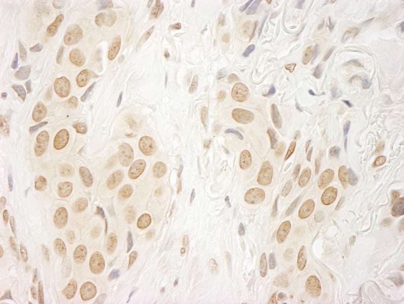 FAC1 / BPTF Antibody (aa1350-1400)