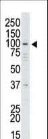 USP13 Antibody (aa389-419)