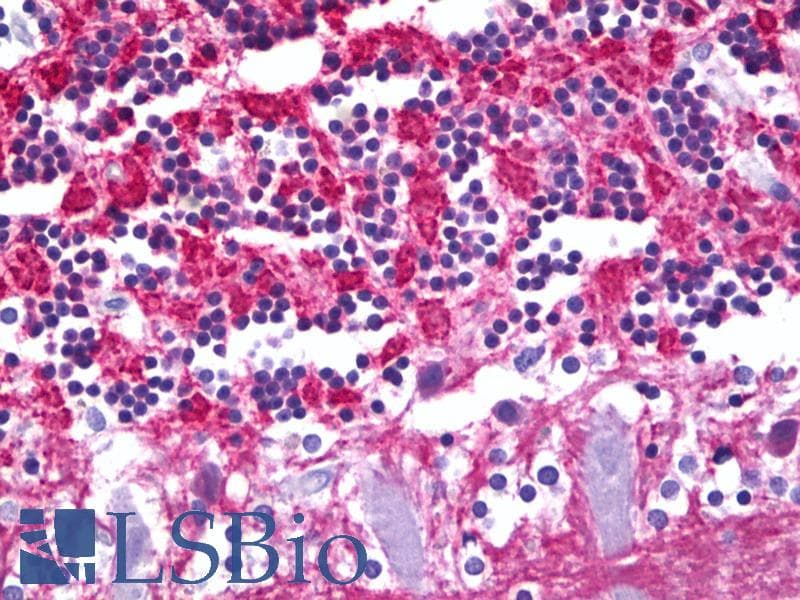 PathPlus™ SYN1 / Synapsin 1 Antibody