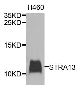 Polyclonal Rabbit anti-Human STRA13 Antibody (WB)