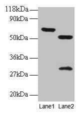 Polyclonal Rabbit anti-Human ZNF384 Antibody (IHC, WB)