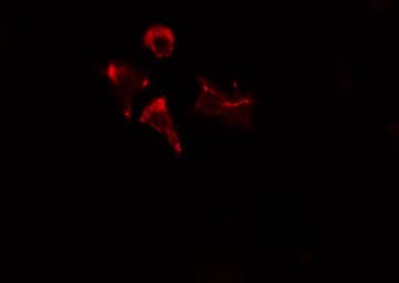 Polyclonal Rabbit anti-Human TTF / RHOH Antibody (IF, WB)