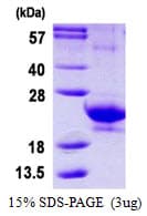 Human IFNA14 / Interferon Alpha 14 Protein (Recombinant His)