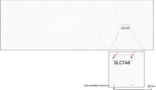 SLC7A8 / LAT2 Antibody (clone UMAB70)