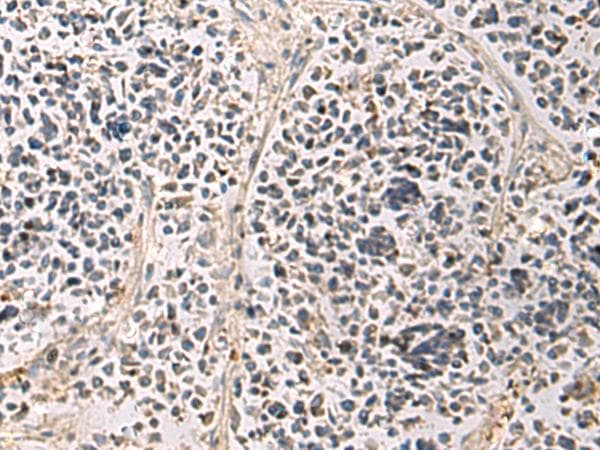 PAIP1 Antibody