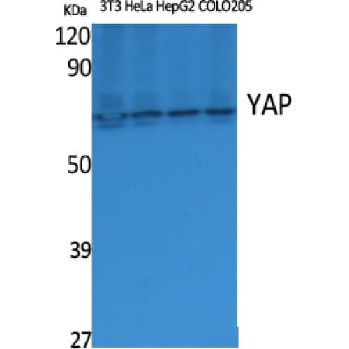 YAP / YAP1 Antibody (250-330 aa, Internal)