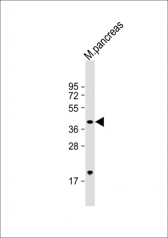 GMPPB Antibody (Internal)