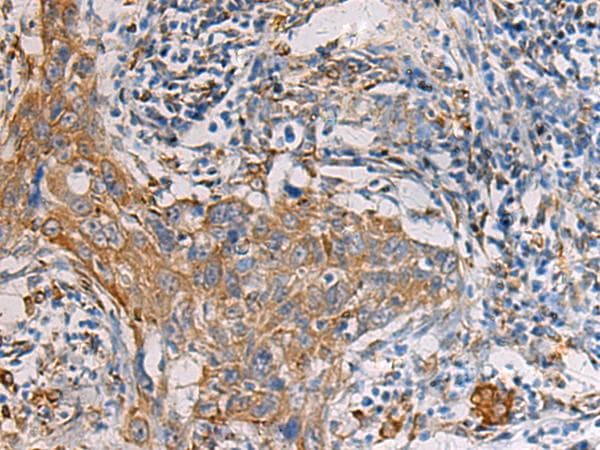 Polyclonal Rabbit anti-Human PAIP1 Antibody (IHC, WB)