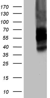 VSIR / GI24 / VISTA Antibody (clone OTI7A6D5)