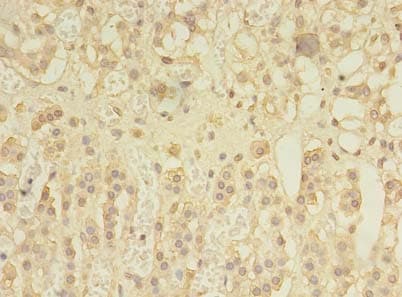 SPRY1 / Sprouty 1 Antibody