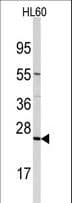 TRAPPC4 / Synbindin Antibody (aa54-84)