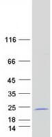 Human MORN5 Protein (Recombinant Myc-DDK (Flag))