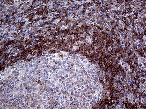 Monoclonal Mouse anti-Human ARHGEF18 Antibody (clone OTI6D10, Carrier-free, aa118-215, IHC, WB)