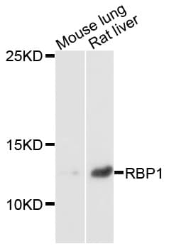 Polyclonal Rabbit anti-Human RBP1 / CRBP Antibody (WB)