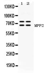 Polyclonal Rabbit anti-Human MPP2 Antibody (WB)