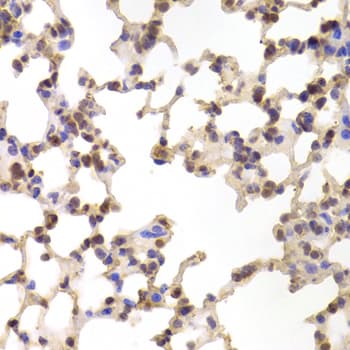 ALOX15B / 15-LOX-2 Antibody
