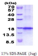 Human CCL25 / TECK Protein (Recombinant His)