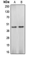 Polyclonal Rabbit anti-Human CASP4 / Caspase 4 Antibody (Internal, IHC, WB)