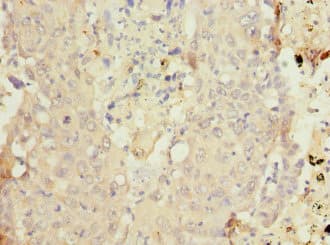 Polyclonal Rabbit anti-Human CYP4B1 Antibody (IHC)
