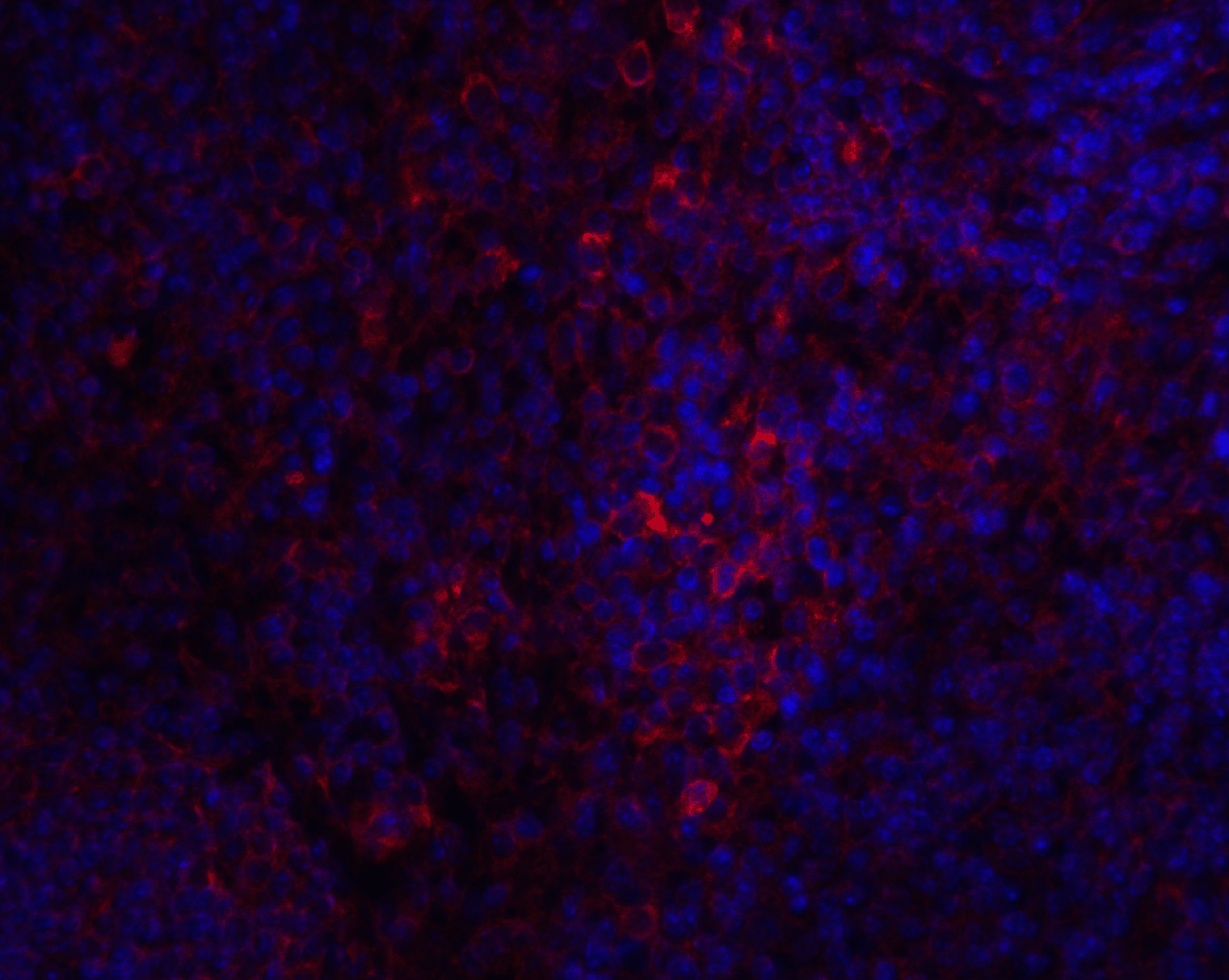 IHC-plus™ GOK / STIM1 Antibody