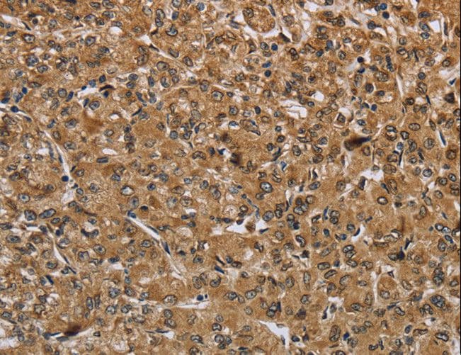 Polyclonal Rabbit anti-Human IKBIP Antibody (IHC)