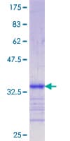 Human LRP5 Protein (Recombinant GST, N-terminus)