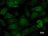 KAT5 / TIP60 Antibody (clone 3557C4a)