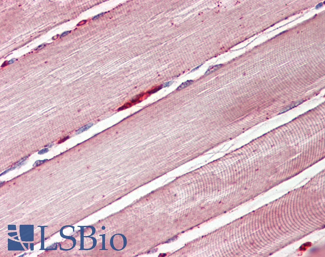 IHC-plus™ Polyclonal Goat anti-Human SLC2A4 / GLUT-4 Antibody (aa498-509, IHC, WB)