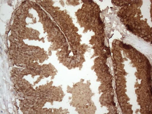 Monoclonal Mouse anti-Human KLK3 / PSA Antibody (clone OTI2F3, Carrier-free, aa25-261, IHC, WB)