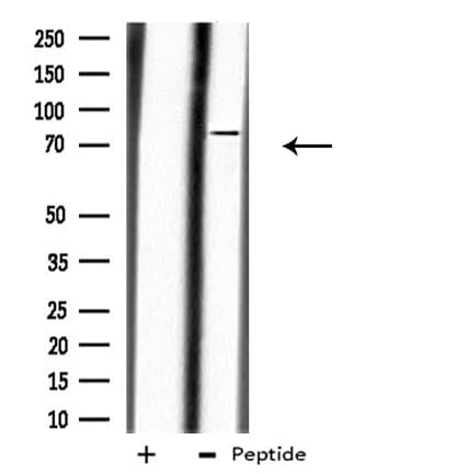 Polyclonal Rabbit anti-Human CAPN10 / Calpain 10 Antibody (IF, WB)