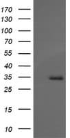 IHC-plus™ MAGEA4 Antibody (clone 1F9)