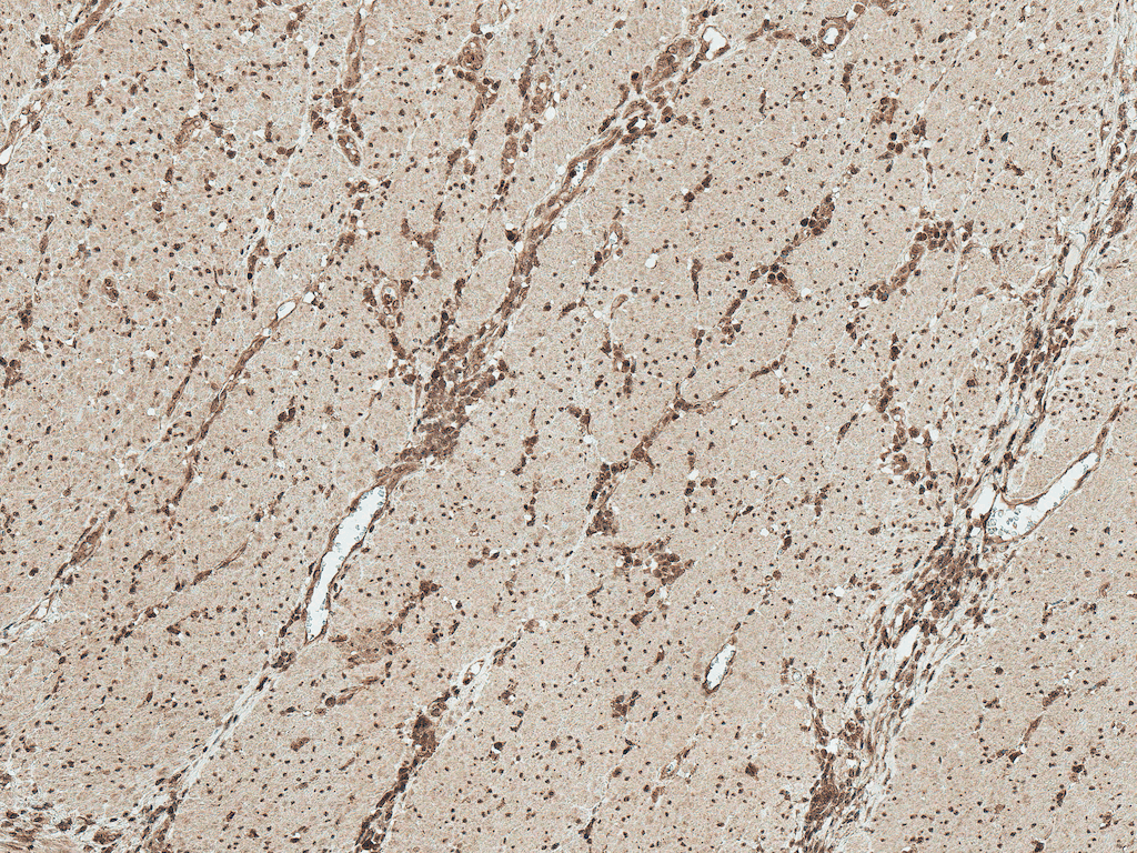 MAP2K1 / MKK1 / MEK1 Antibody (RPE)