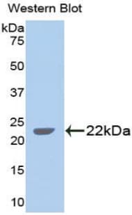 GDF5 / GDF-5 Antibody (aa358-495)
