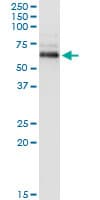 Monoclonal Mouse anti-Human PPM1B Antibody (clone 1A3-2A4, IF, WB)