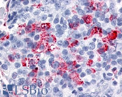PathPlus™ Polyclonal Rabbit anti-Human ESRRG / ERR Gamma Antibody (C-Terminus, IHC, WB)