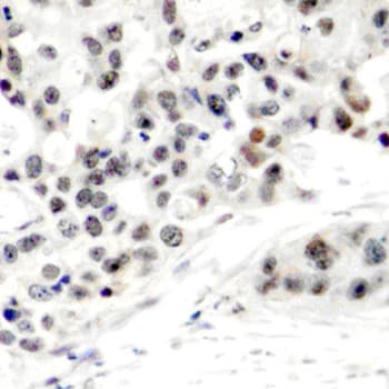 Polyclonal Rabbit anti-Human ER Alpha / Estrogen Receptor Antibody (phospho-Ser106, IHC, IF, WB)