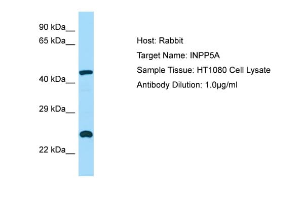Polyclonal Rabbit anti-Human INPP5A Antibody (aa263-312, WB)
