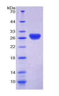 Rat TRXR1 / TXNRD1 Protein (Recombinant His-T7)