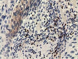 EPHX2 / Epoxide Hydrolase 2 Antibody (clone OTI1A6, Carrier-free)
