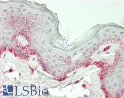 IHC-plus™ CDH3 / P-Cadherin Antibody (clone 2D5)