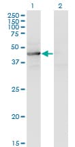 Monoclonal Mouse anti-Human TEX28 Antibody (clone 1A8, WB)