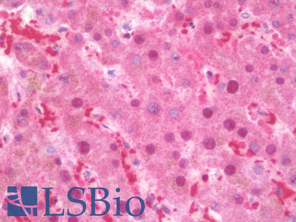 IHC-plus™ Polyclonal Rabbit anti-Human TLX2 / NCX Antibody (IHC, IF, WB)