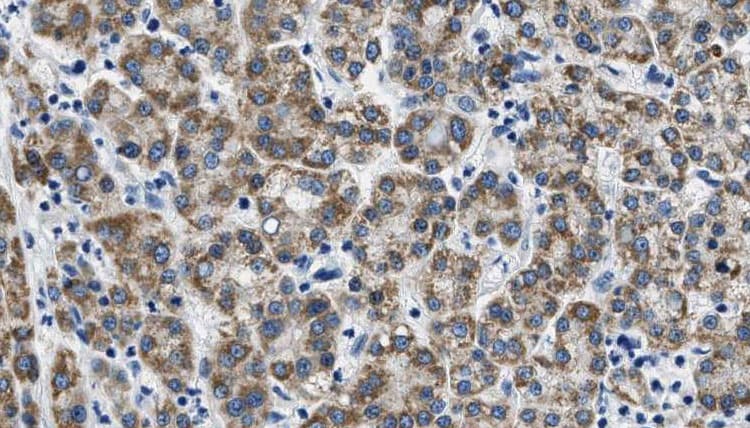 MIP / AQP0 / Aquaporin 0 Antibody