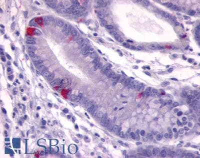 IHC-plus™ GPR148 Antibody (C-Terminus)