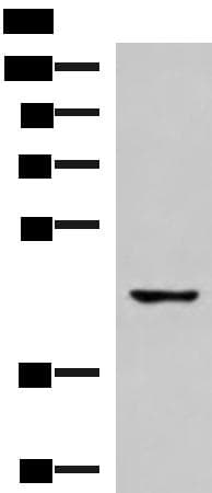 TRAIL-R4 / DCR2 Antibody